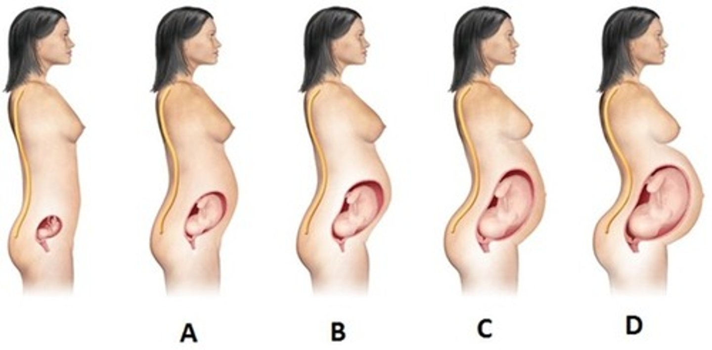 <p>B) B</p><p>In the 28th week of gestation, the baby is becoming large enough that it is increasingly causing lordosis of the lumbosacral spine.</p><p>A-12 W</p><p>B-28 W</p><p>C-36W</p><p>D40 W</p><p>P211</p>