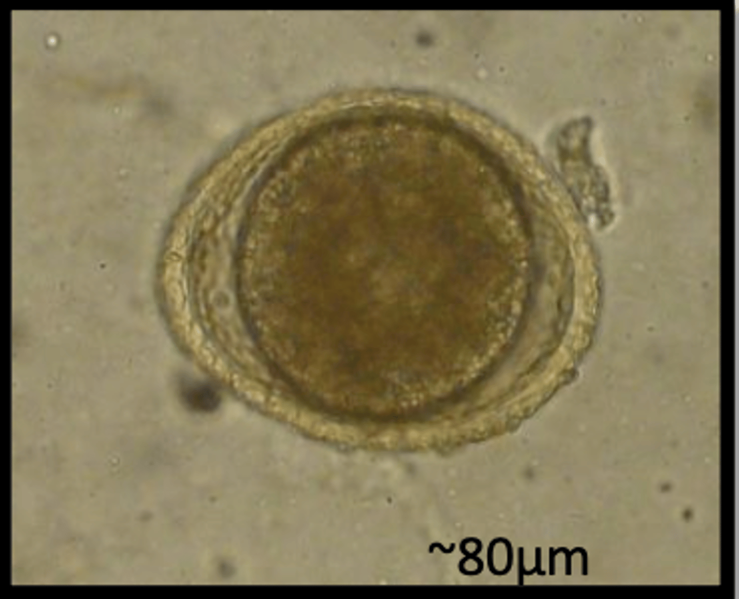<p>Found in a puppy with pot belly. What parasite species does this egg belong to?</p>