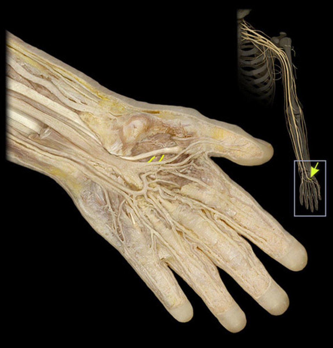 knowt flashcard image