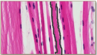 <p>Skeletal Muscle</p>