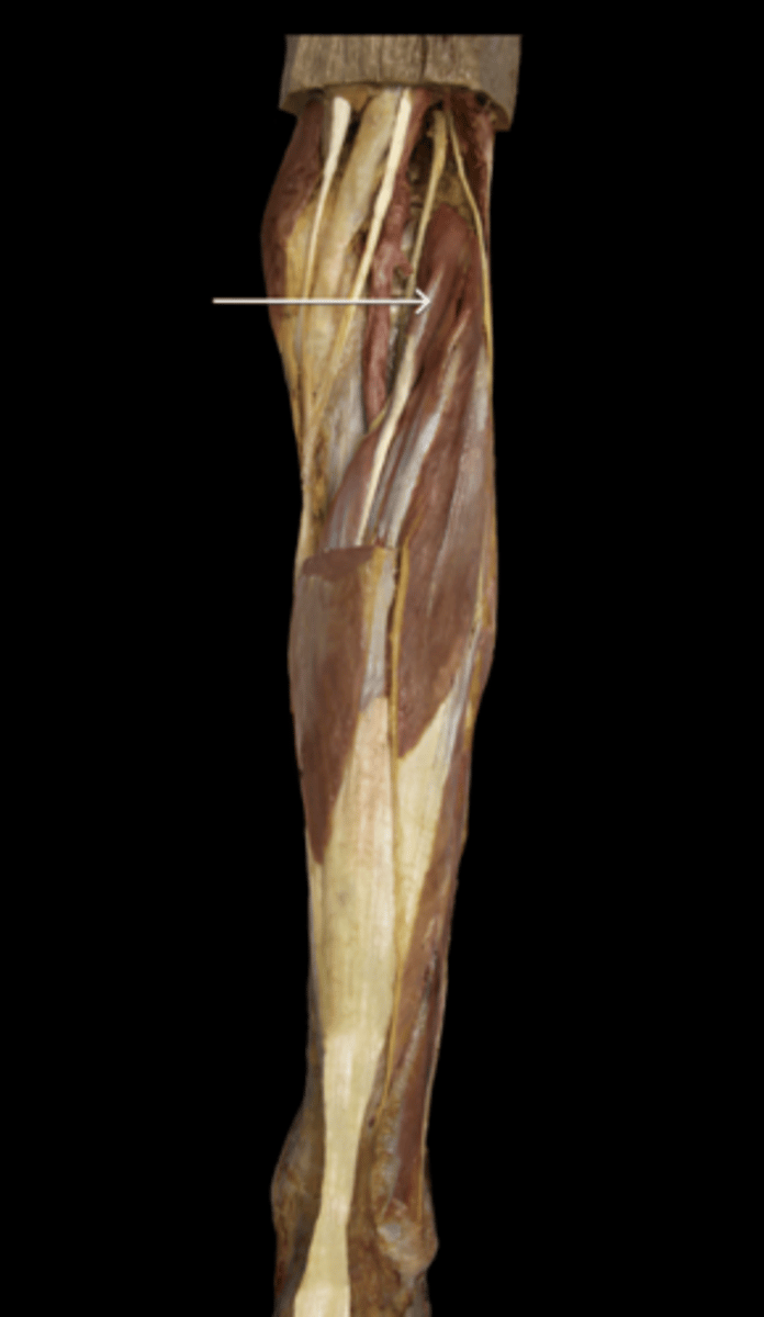 <p>Posterior view lower leg</p>