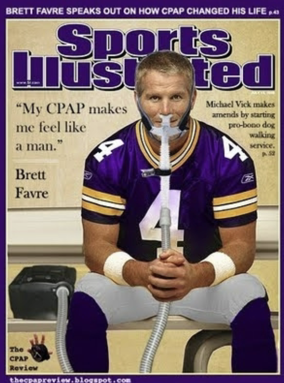 <ul><li><p><span style="color: rgb(224, 134, 15);"><u>Temporary cessation (stop) of breathing during the night</u></span> (can mean snoring, but not always)</p></li><li><p>Daytime symptoms: irritability, fatigue (despite sleeping a lot)</p></li><li><p>Positive correlation between sleep apnea and obesity </p></li></ul><ol><li><p>Central: issue w/ brain (Reticular Formation), need surgery</p></li><li><p>Obstructive: issue with air passage in throat (not brain)</p></li></ol><ul><li><p>Treatments:</p><ul><li><p><span style="color: rgb(219, 127, 18);"><u>CPAP (Continuous Positive Airway Pressure) Machine:</u></span> forces air through nose to maintain steady air flow, keeping you breathing</p></li><li><p>Surgery</p></li></ul></li></ul><p></p>