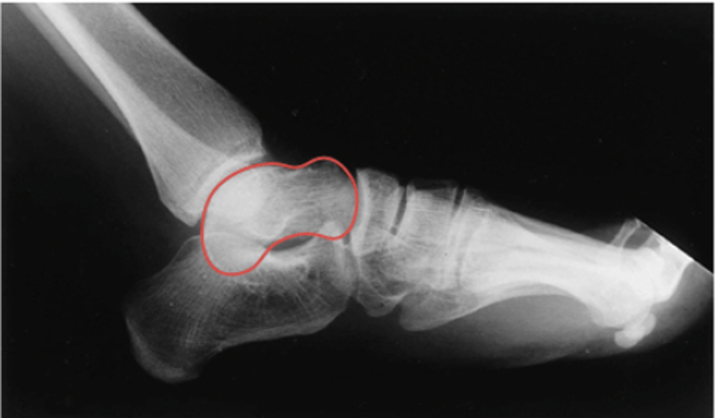 <p>What structure is highlighted?</p>