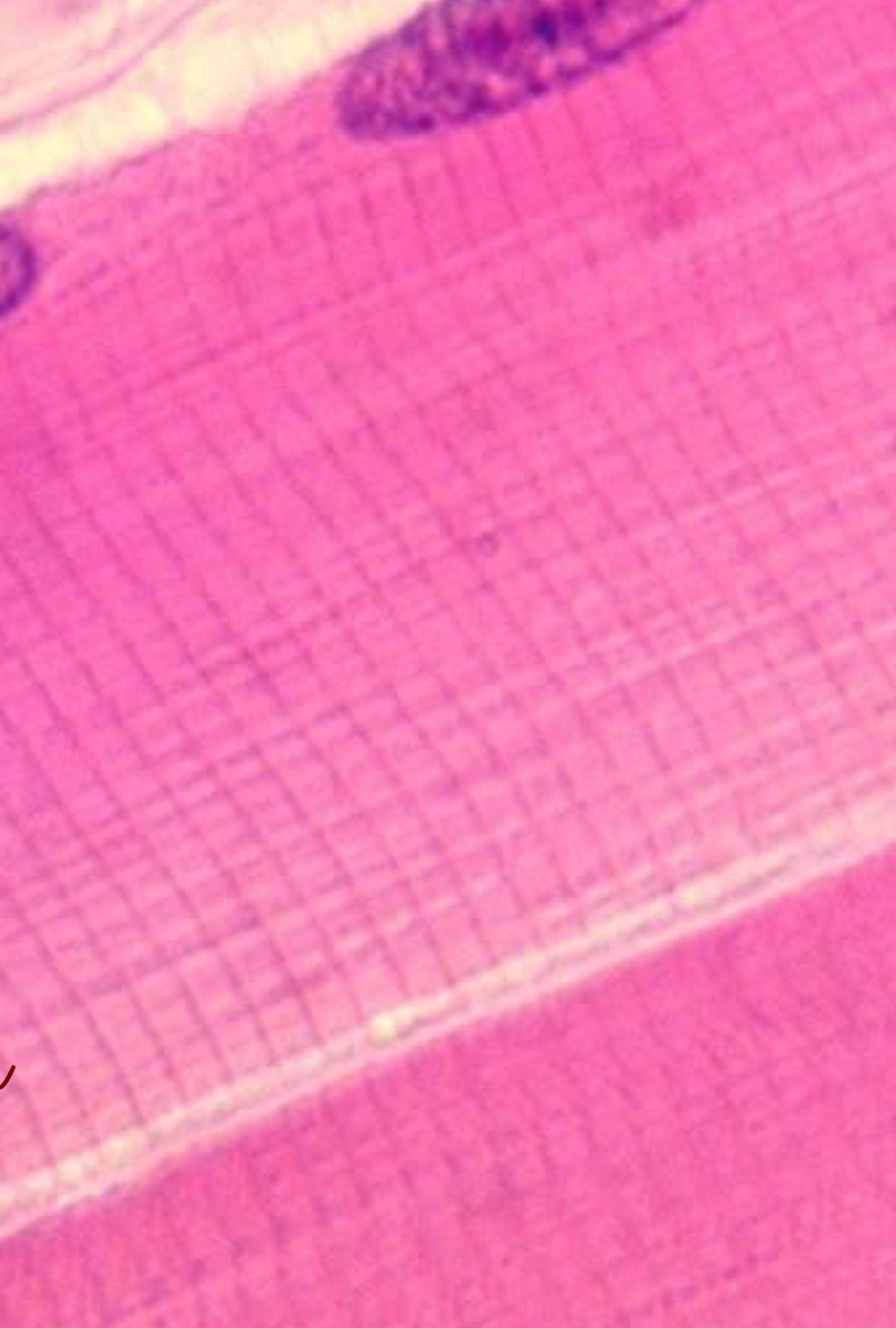 criss-cross pattern = striations - regular pattens of contractile proteins within fibres