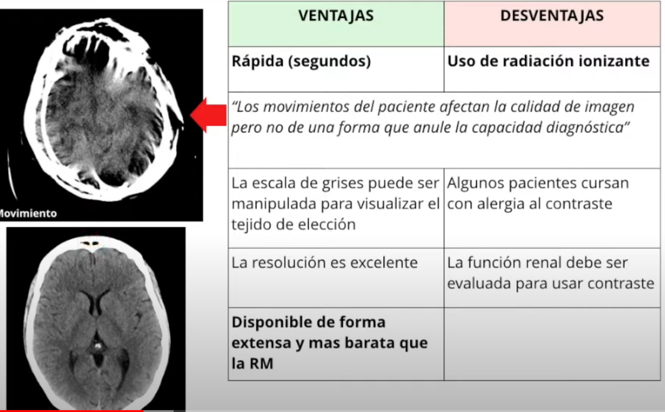 <p><span style="color: red"><strong>PX con daño renal (Nefropatía) no se solicita medio de contraste xq el yodo es nefrotóxico. Px con enf renal crónica terminal, como sus riñones no sirven, normal se puede hacer una TAC con contraste</strong></span></p>
