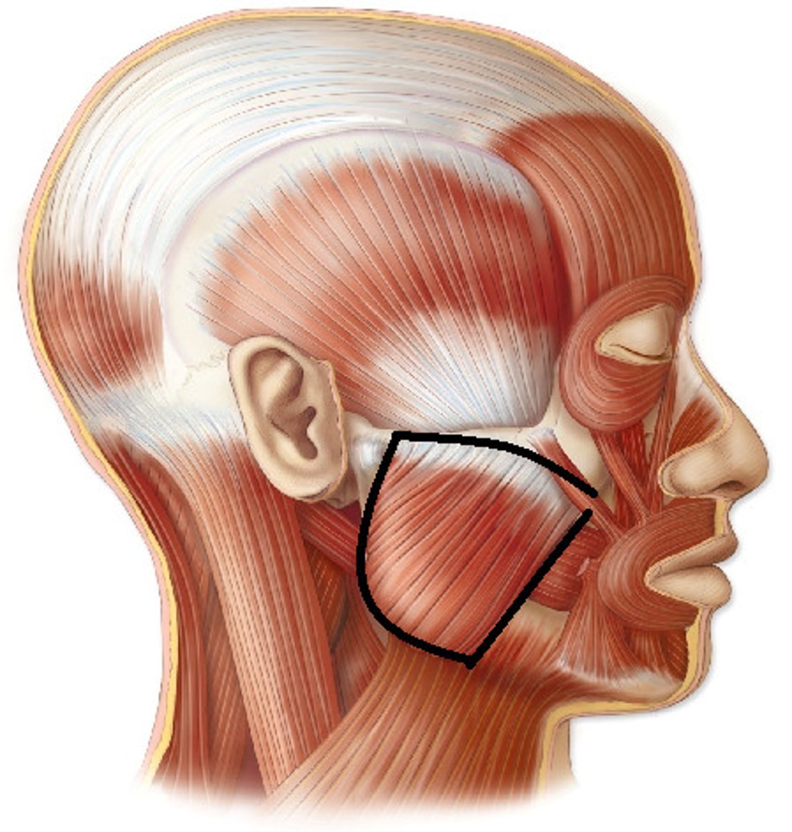 <p>what muscle of mastication is most likely to become enlarged due to bruxism?</p>