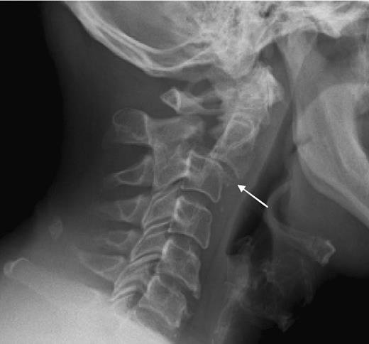 <p>hangman’s fx</p>