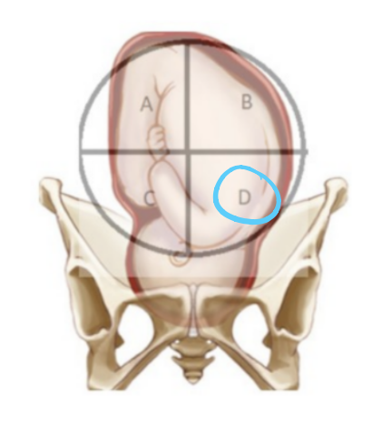 <ul><li><p>on baby’s back</p></li><li><p>assess fetal heart rate/tones </p></li><li><p>baseline/normal FHTs 110-160</p></li><li><p>variability</p></li><li><p>accelerations (15 beats x 15 sec)</p></li><li><p>decelerations</p></li></ul>