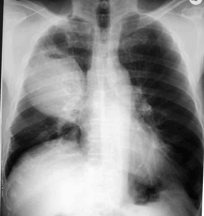 <p>What is the classification of this pathology?</p>