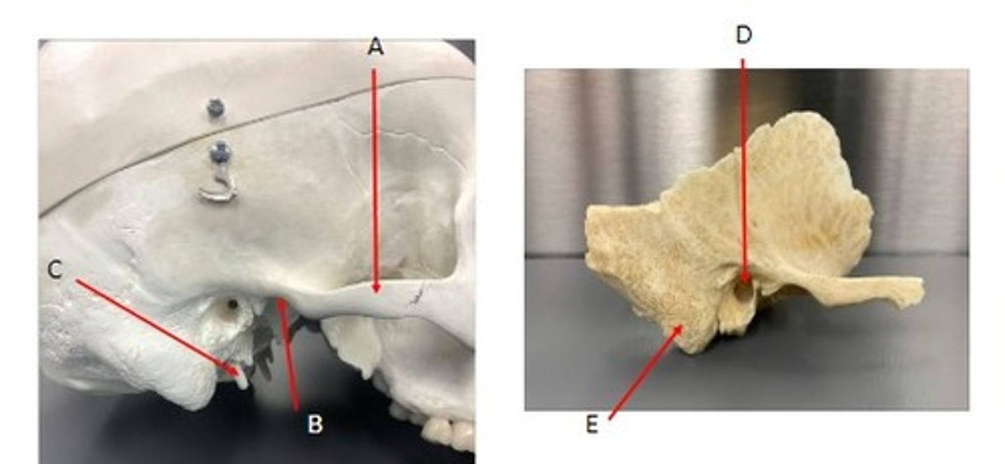 <p>What category of bone is it? What bone is it? What region is it? Label the structures.</p>