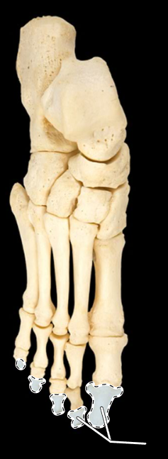 <p>Name this group of bones.</p><p>(Superior view, right side).</p>
