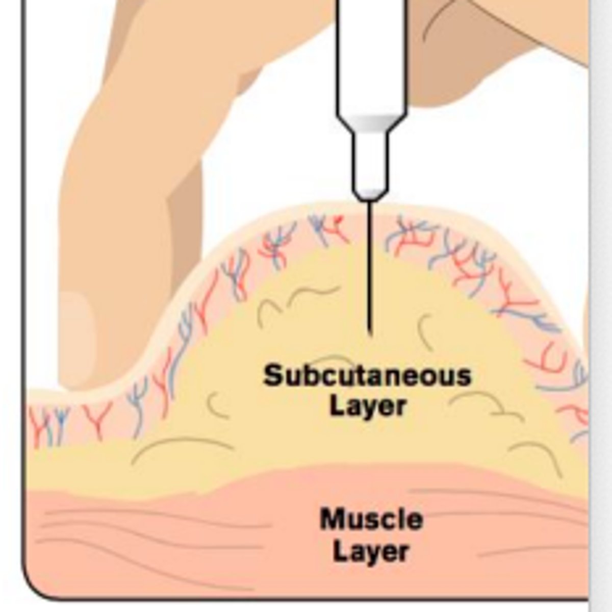 <p>Drug injected into subcutaneous tissue with slower absorption than IM.</p>