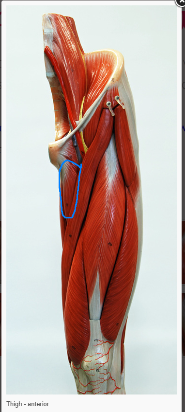 <p>what is the name of the muscle circled&nbsp;</p>