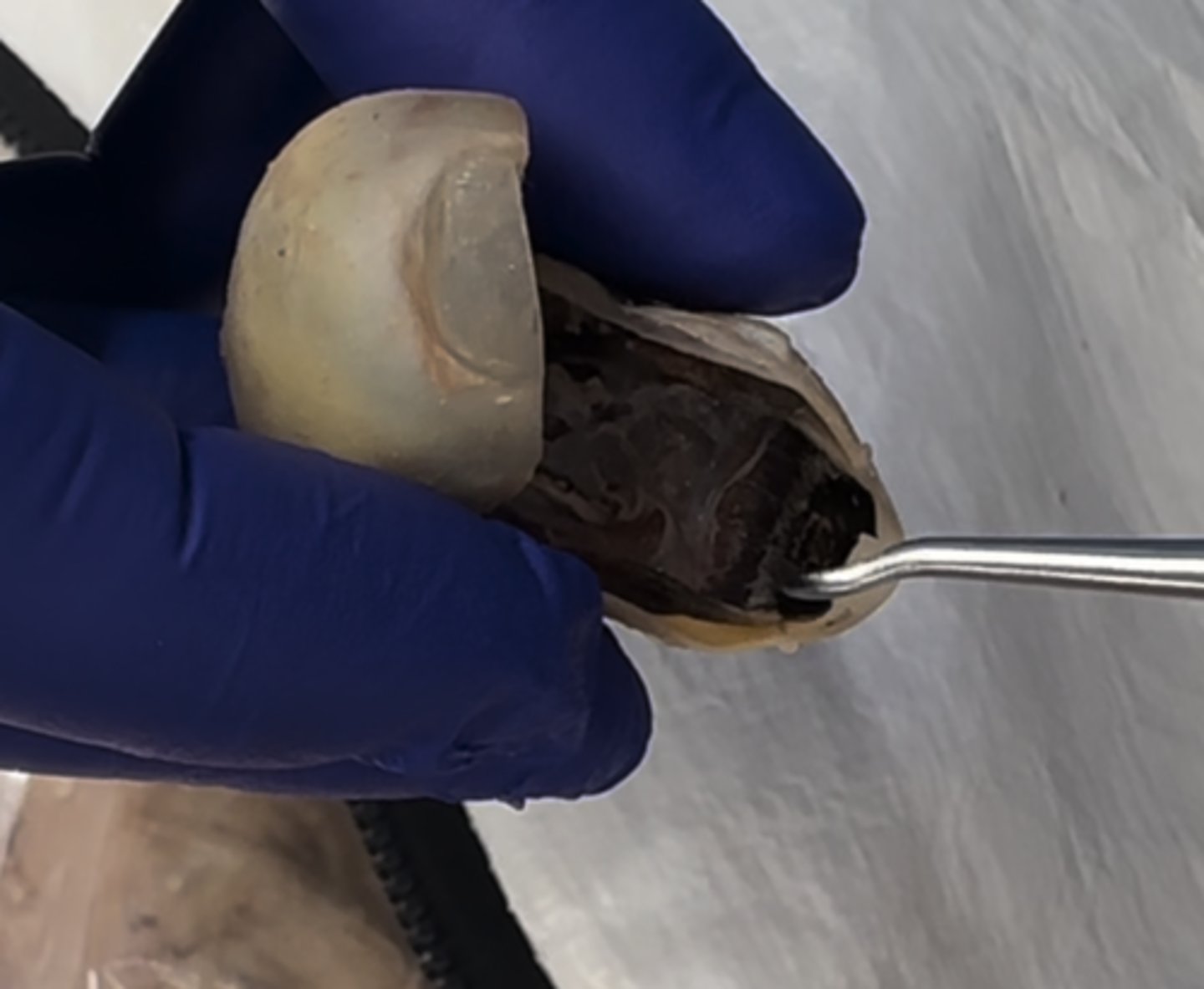 <p>The "white ring" area around the iris is the</p>