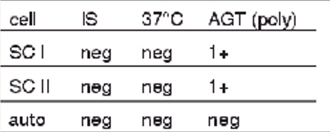 <p>antibody screen results + possible interpretations</p><ul><li><p>1+ at AHG w SCI and SCII</p></li></ul><p></p>