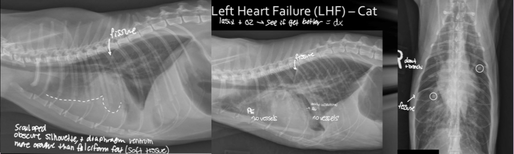 <p>-fissures lines with lungs</p><p>-no vessels can be traced</p>