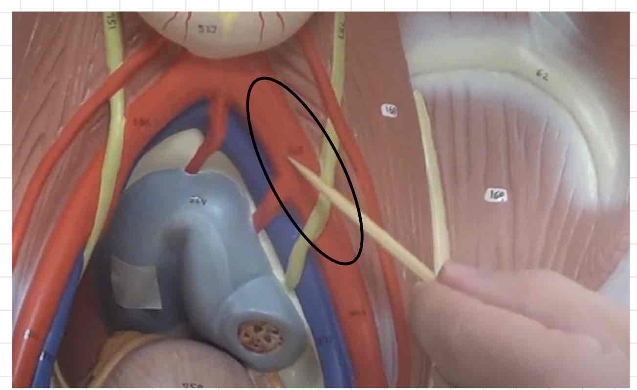 <p>what is this? (torso model)</p>
