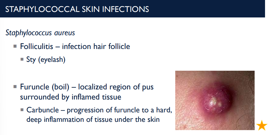 <p><em>Staphylococcus aureus</em> can cause a skin infection called furuncle (boil). Describe it.</p>