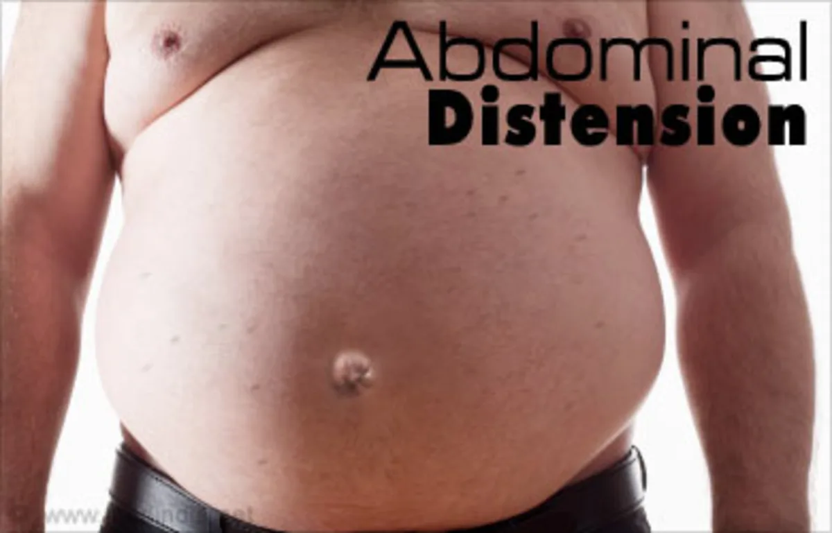 Increased abdominal girth resulted from increased intra-abdominal pressure forcing the abdominal wall outward 