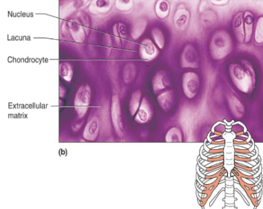<p><span>cartilage that supports and reinforce due to resilient cushioning properties, resists compressive stress</span></p>