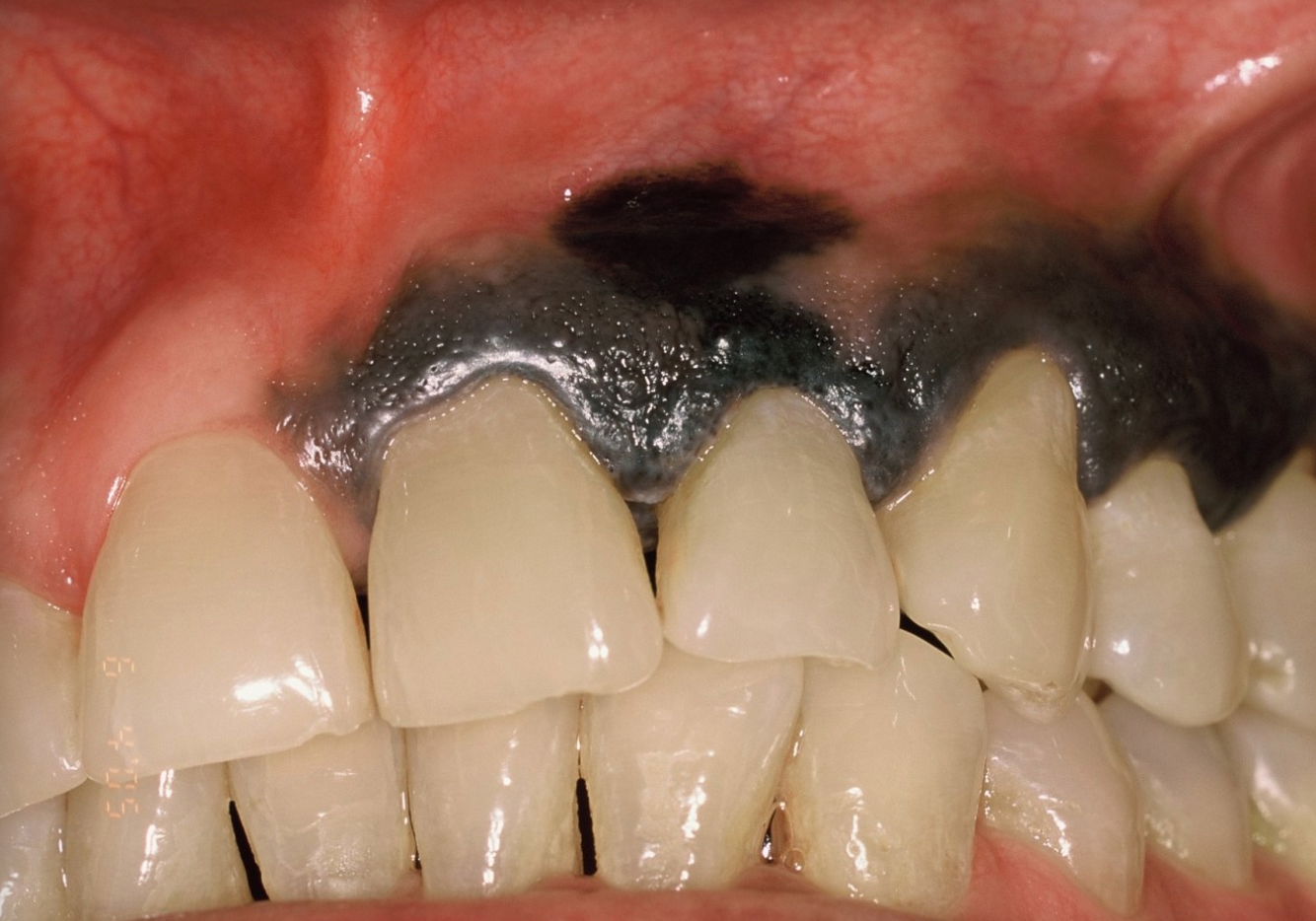 <p>10b. What is the appropriate next step after clinical examination?</p>