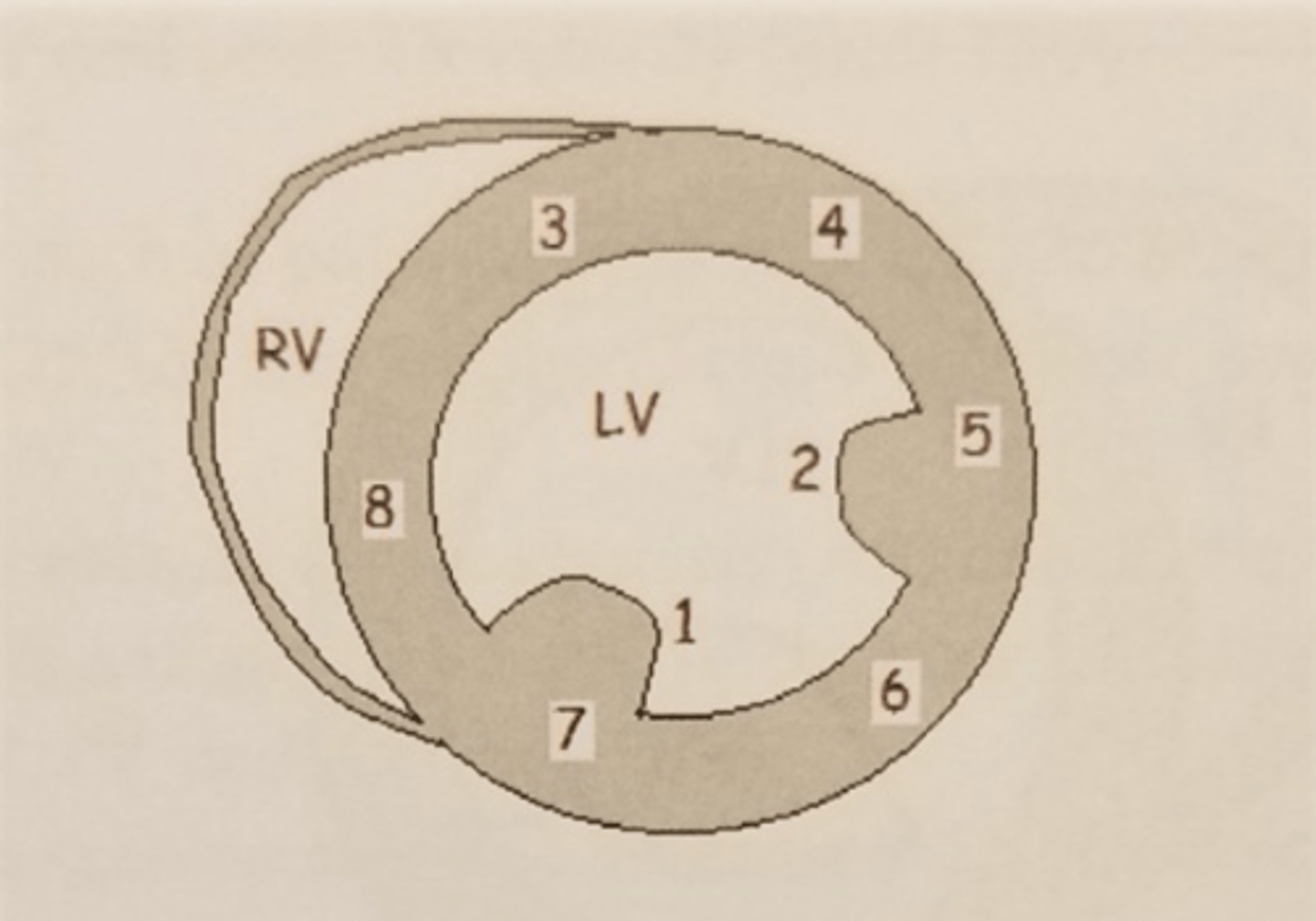 <p>PM- posterior medial</p>