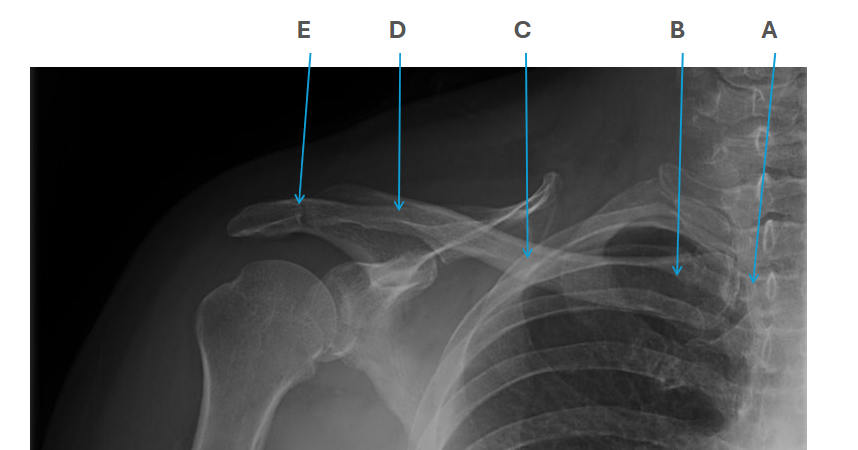 <p>what is clavicle C</p>