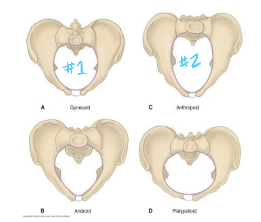 <ol><li><p>maternal (immovable) pelvis</p><ul><li><p>gynecoid and anthropoid are best</p></li></ul></li><li><p>soft tissues (cervix, pelvic floor, vagina)</p><ul><li><p>cervix dilates and effaces</p></li><li><p>vaginal canal distends</p></li></ul></li></ol>