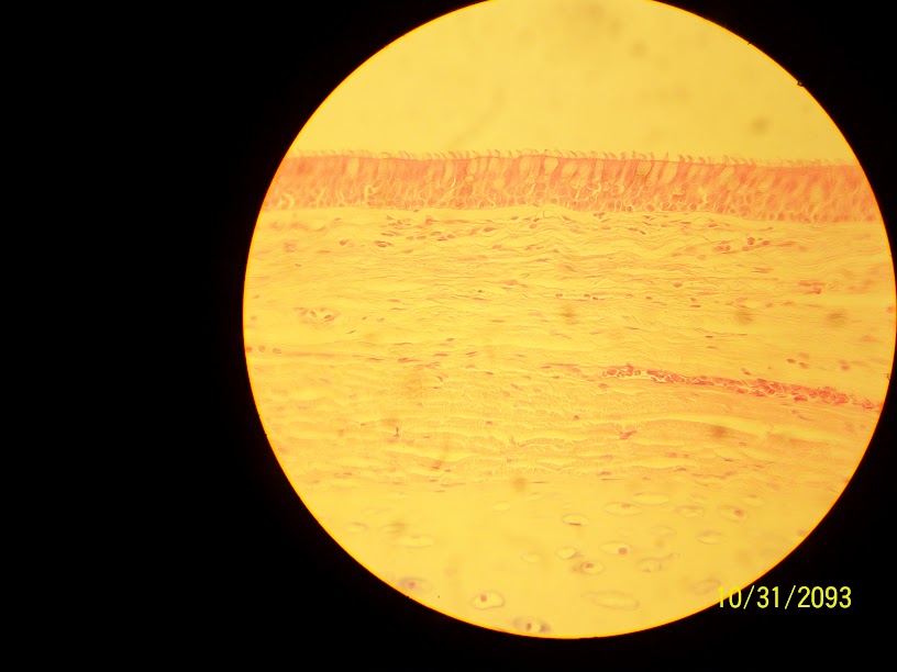 <p>Pseudostratified Ciliated Columnar Epithelium</p>