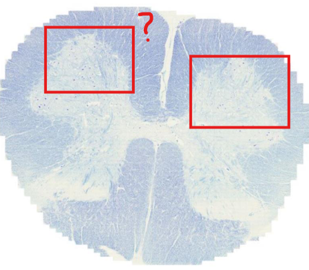 <p>what is this?</p><p>what neurons are here?</p>