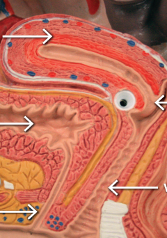 <p>top left arrow&nbsp;</p>