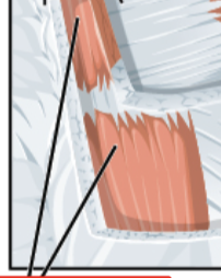 <p><span style="color: red;"><span>Origin: Pelvic bone </span></span></p><p><span style="color: yellow;"><span>Insertion: sternum (xiphoid process)</span></span></p><p><span style="color: rgb(127, 255, 212);"><span>Action: trunk flexion, compression of abdomen</span></span></p>