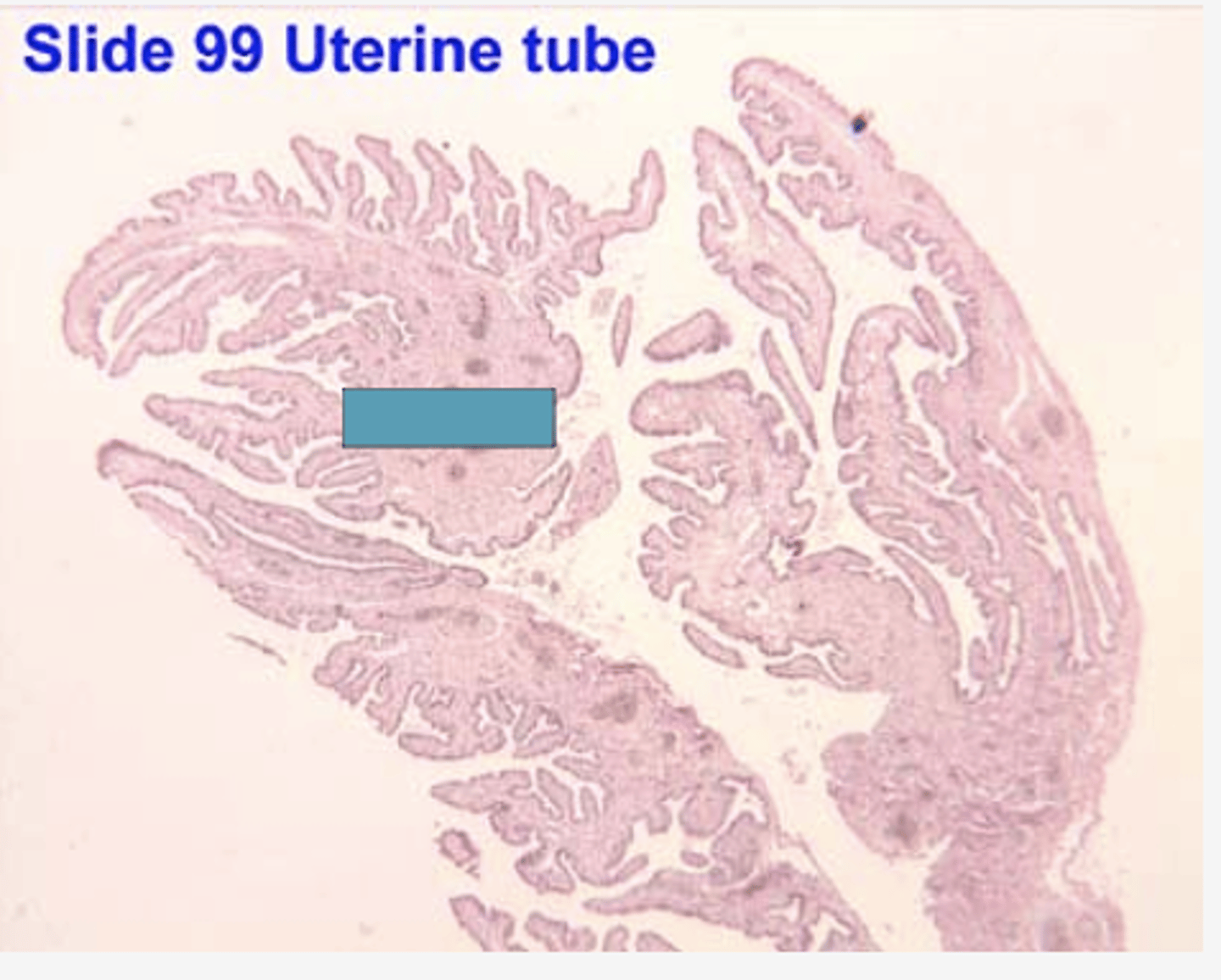 <p>Identify the structure</p>