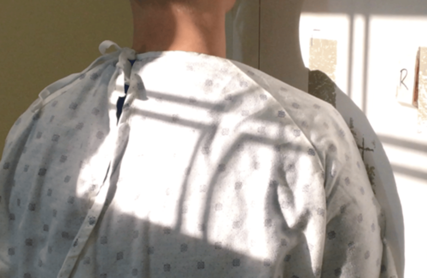 <p>Pt Placement: patient has affected shoulder against bucky and rotated 45 degrees away</p><p>Collimation: 10x12</p><p>CR Placement: Upper medial border of scapula (CR comes out of humeral head and across AC joint)</p><p>Tube tilt: 15 caudal </p><p>SID: 40"</p><p>Breathing: DBDM</p>