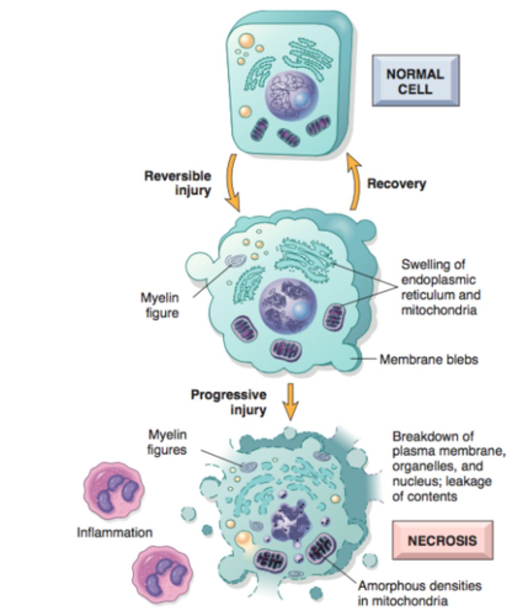 <p>increased eosinophilia, nuclear shrinkage, fragmentation, and dissolution of plasma membrane and organelle membranes, abundant myelin figures, leakage and enzymatic digestion of cellular contents</p>