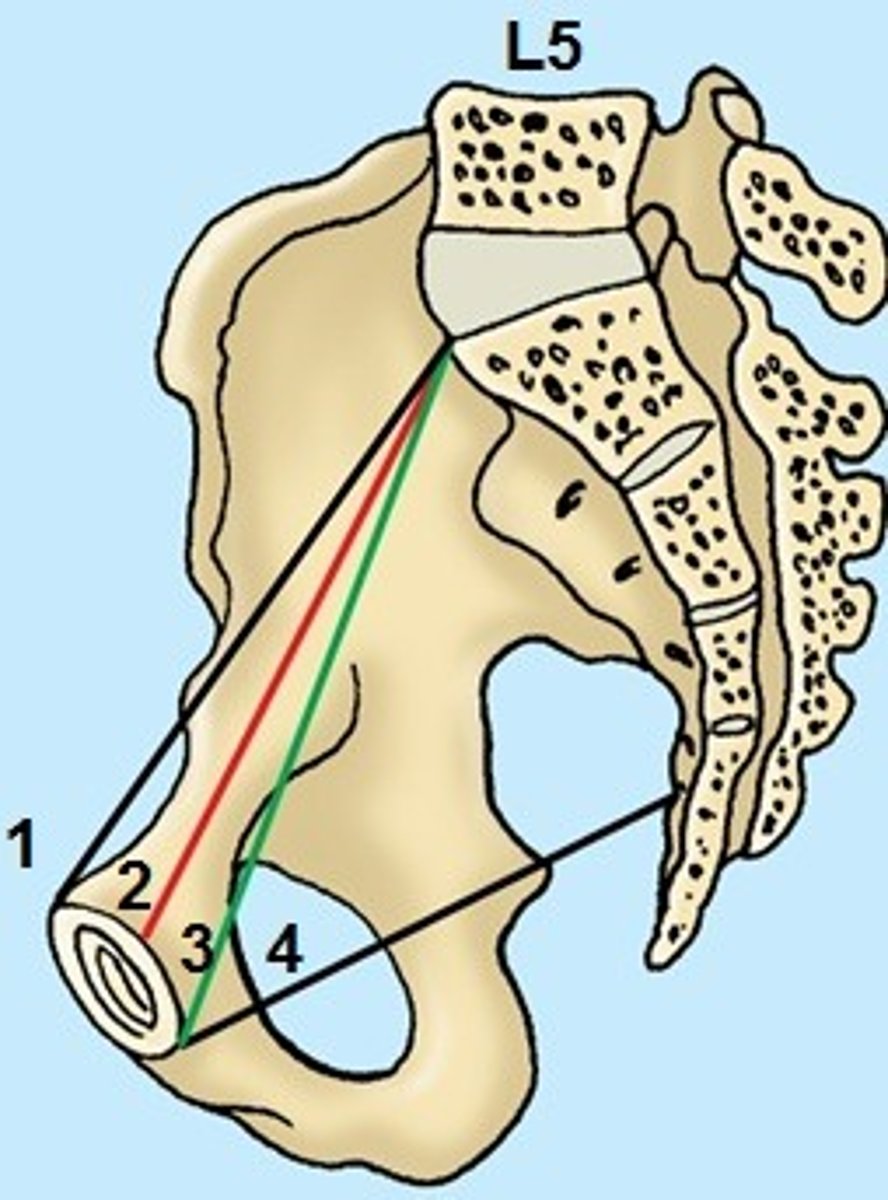 <p>-Most useful in estimating pelvic size</p><p>-Fetal head passes through here first</p><p>-Should be 11.5 cm or greater</p><p>-false pelvis directs the baby into the true pelvis</p><p>-Distance between anterior surface of sacral prominence and anterior surface of symphysis pubis.</p>