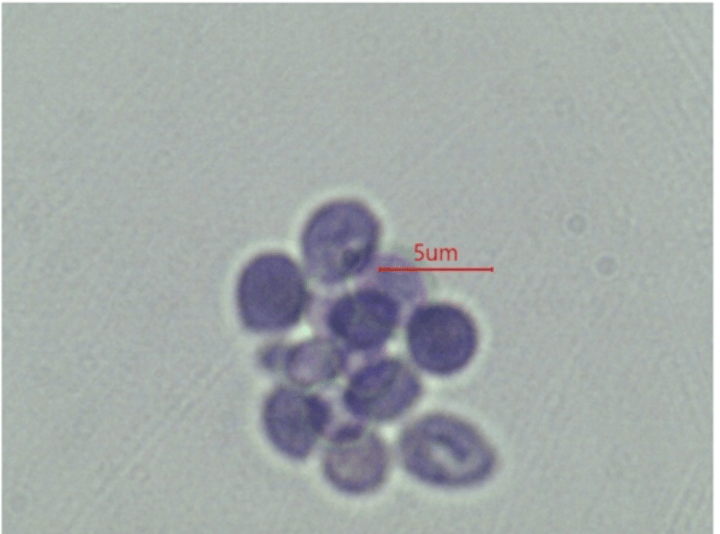 <p>What phylum do Sacchoromyces belong to?</p>