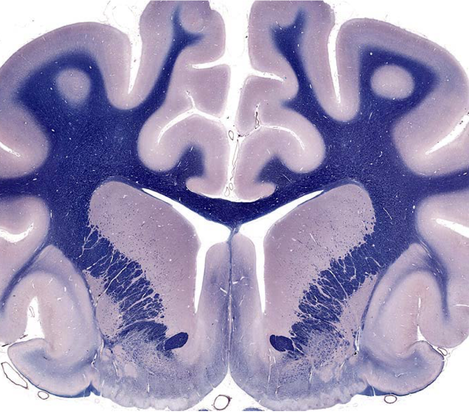 <p>what section of the brain is this?</p>