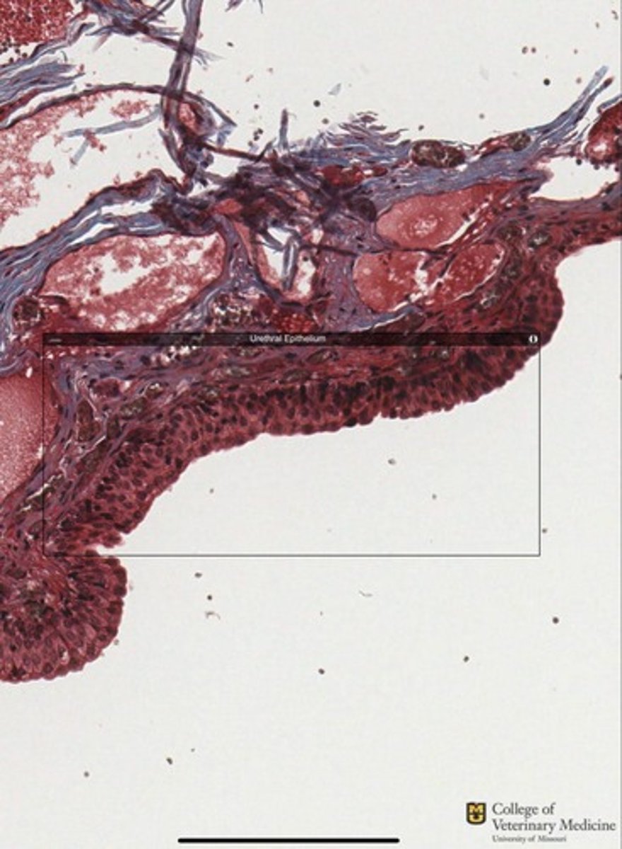 <p>What tissue type is shown?</p>