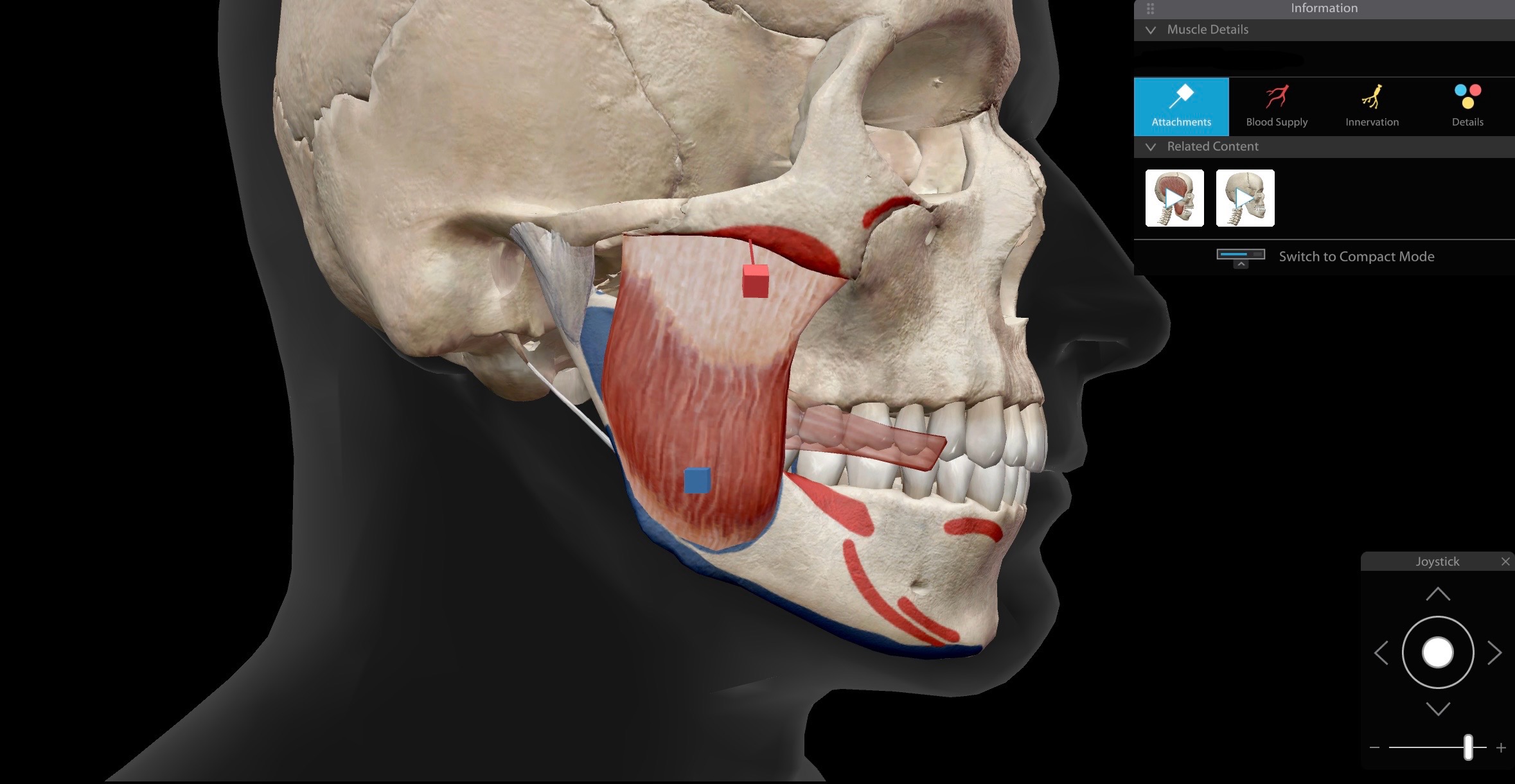 <p>Masseter, superficial, R</p>