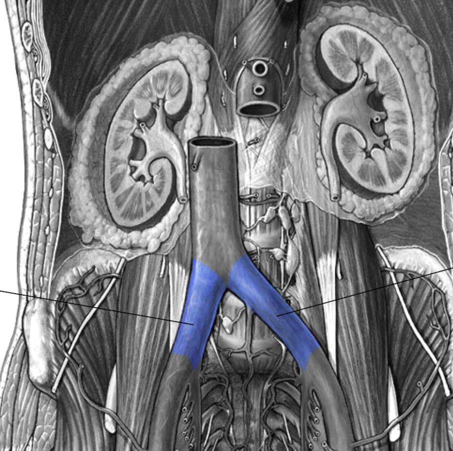 <p>Which veins:</p><ul><li><p>Splits off from inferior vena cava into left &amp; right</p></li><li><p>Inferior to inferior vena cava</p></li><li><p>Superior to internal &amp; external iliac vein</p></li></ul><p></p>