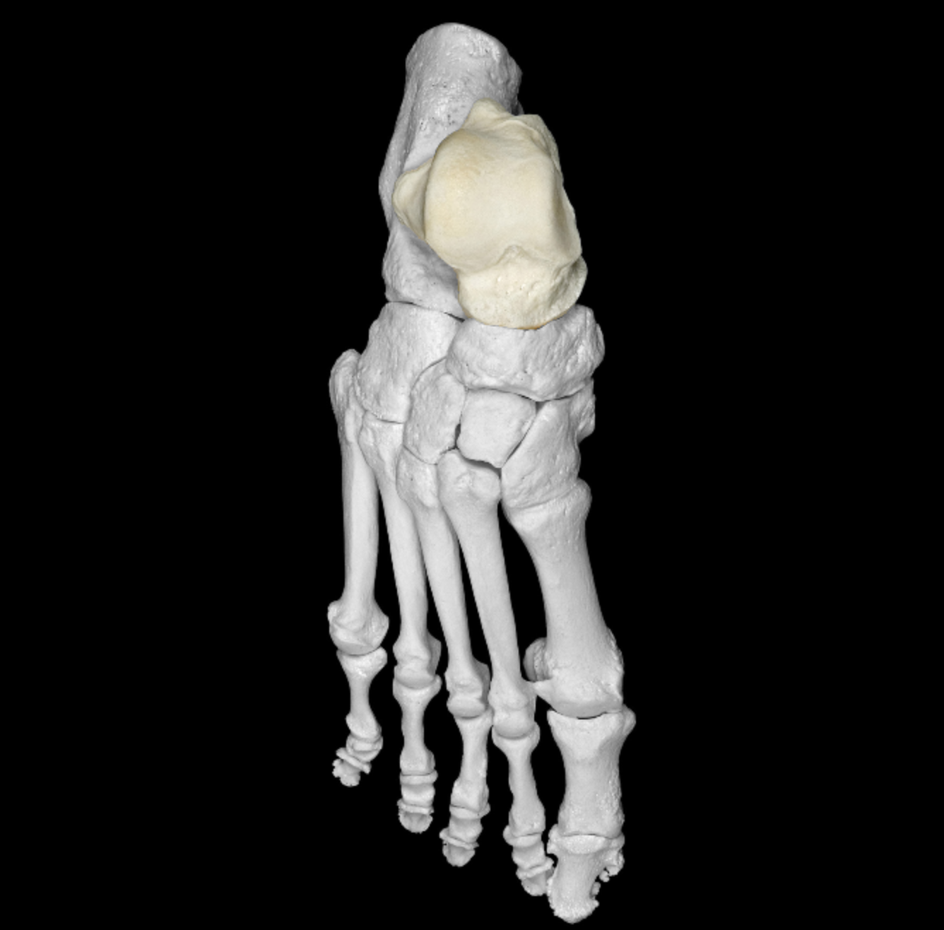 <p>inferior to the trochlea of talus </p>