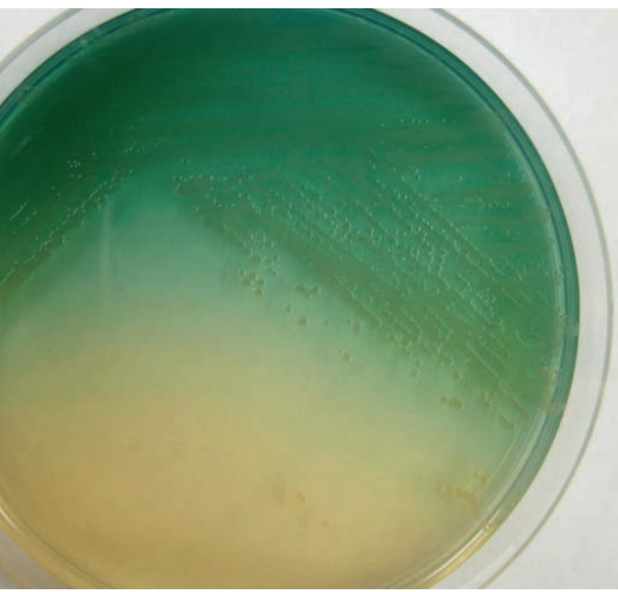 <p>Colonies produce pyocyanin, which is blue or pyoverdin (blue green color)</p>