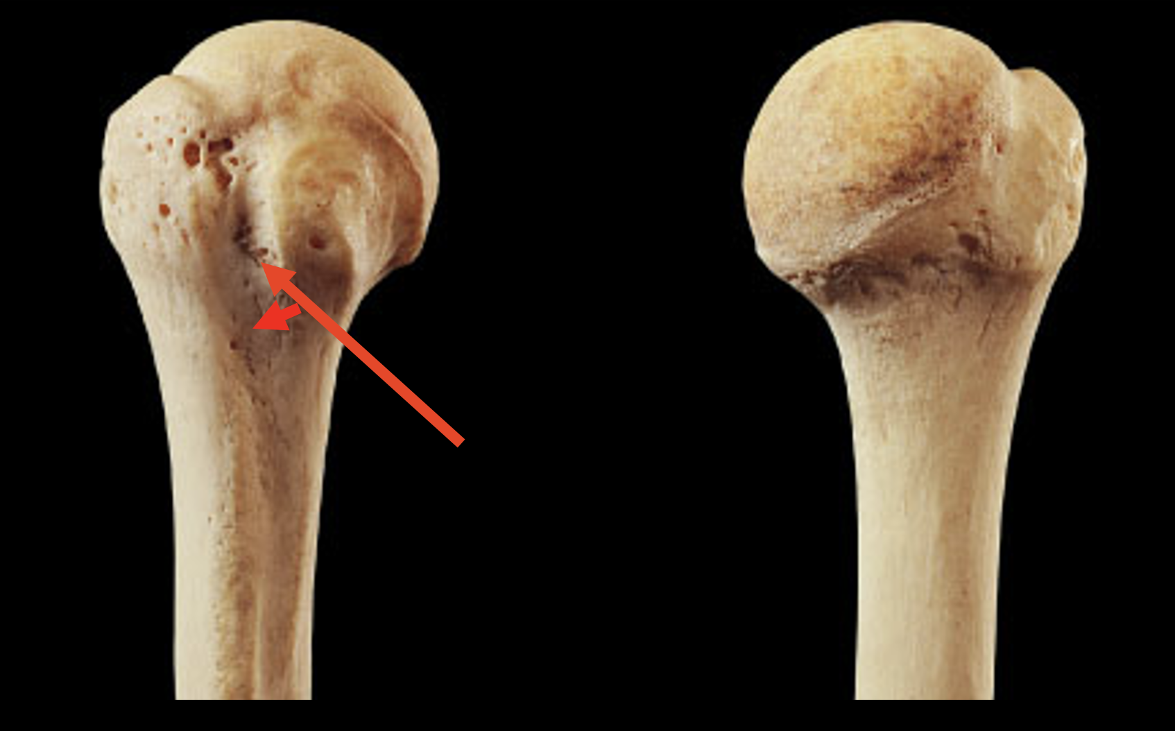 <p>Name this region of the humerus</p>
