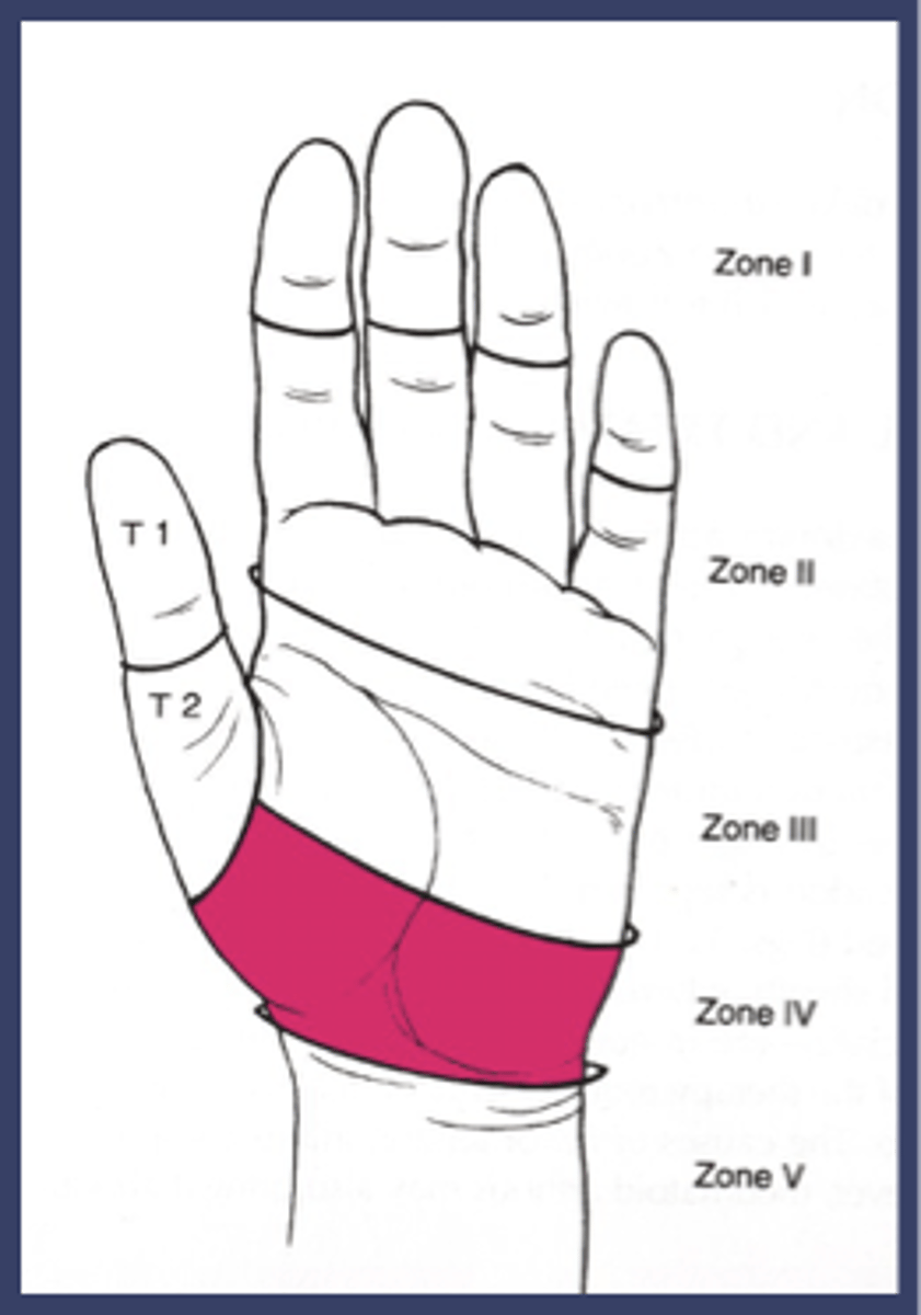 <p>carpal tunnel</p>