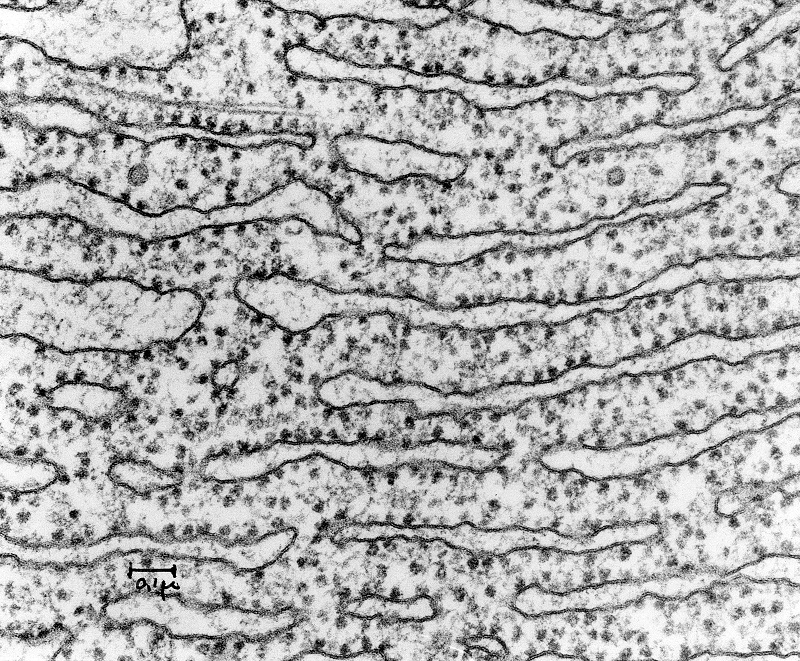 <p>rough endoplasmic reticulum</p>