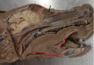 <p>protrudes tongue</p>