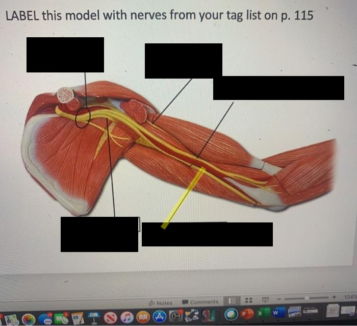 <p>What muscle is this?*****</p>