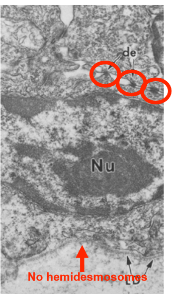 <ul><li><p>leads to loss of hesmidesmosomes, but not cell/cell adhesions that link to IF </p></li><li><p>not attaching to basement membrane, whole sheet comes off </p></li></ul><p></p>