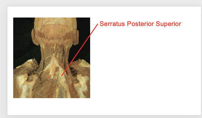<p>serratuss Posterior supeiror</p><p></p><p></p><p>Origin</p><ul><li><p>Ligamentum nuchae</p></li><li><p>Spinous process of C7-T3</p></li></ul><p>Inseration</p><ul><li><p>supeiror border of ribs 2-4</p></li></ul><p></p><img src="https://knowt-user-attachments.s3.amazonaws.com/9647a15b-9274-4b16-adaf-2418e128338c.png" data-width="100%" data-align="center"><p></p>